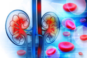 Read more about the article ABO-Incompatible Kidney Transplantation