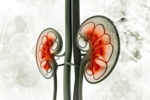 Read more about the article Good practices for dialysis education, treatment,  and eHealth: A scoping review