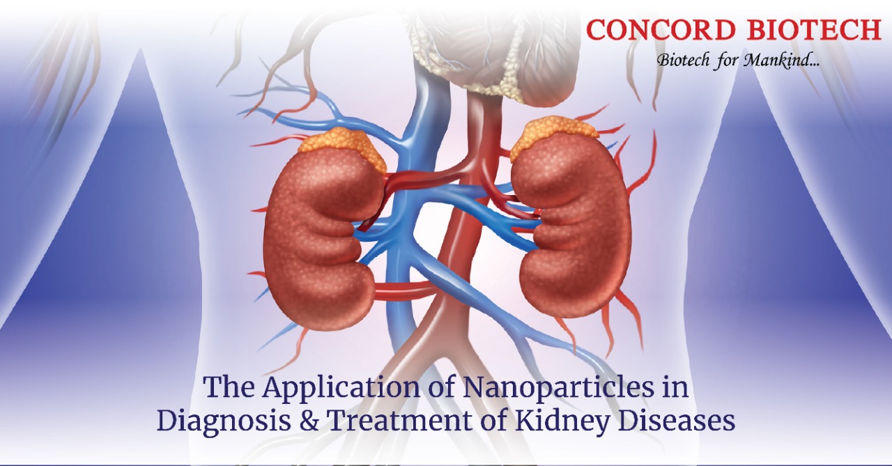The Application of Nanoparticles in Diagnosis and Treatment of Kidney ...