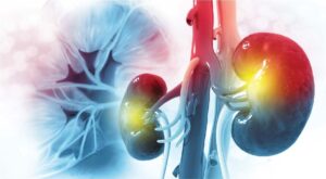 Read more about the article Innovative immunosuppression in kidney transplantation: A challenge for unmet needs