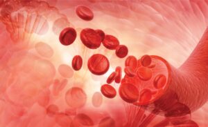 Read more about the article Eltrombopag in Frontline Therapy for Severe Aplastic Anemia: A RACE Against Time