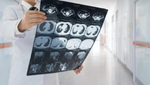 Read more about the article Seeking Standardized Definitions for HLA-incompatible Kidney Transplants: A Systematic Review