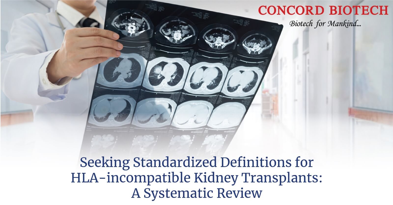 Standardized Definitions for HLA-incompatible Kidney Transplants ...