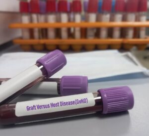 Read more about the article Ruxolitinib on acute graft-versus-host disease prophylaxis after modified donor lymphocyte infusion