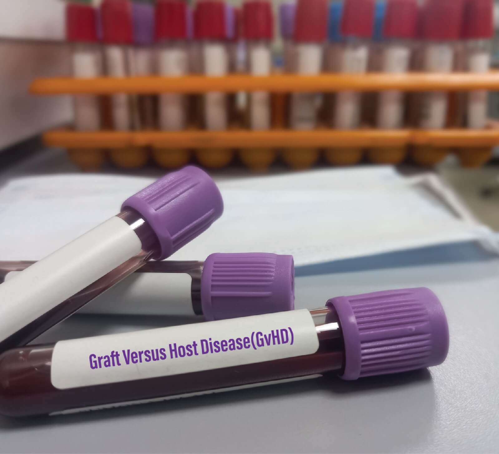 Read more about the article Ruxolitinib on acute graft-versus-host disease prophylaxis after modified donor lymphocyte infusion