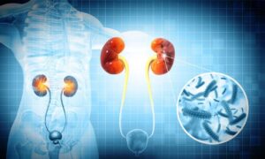 Read more about the article Asymptomatic Bacteriuria in Kidney Transplant Recipients—A Narrative Review