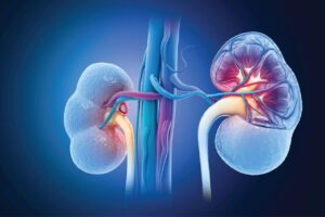 Read more about the article Effects of Delayed Graft Function on Transplant Outcomes: A Meta-analysis