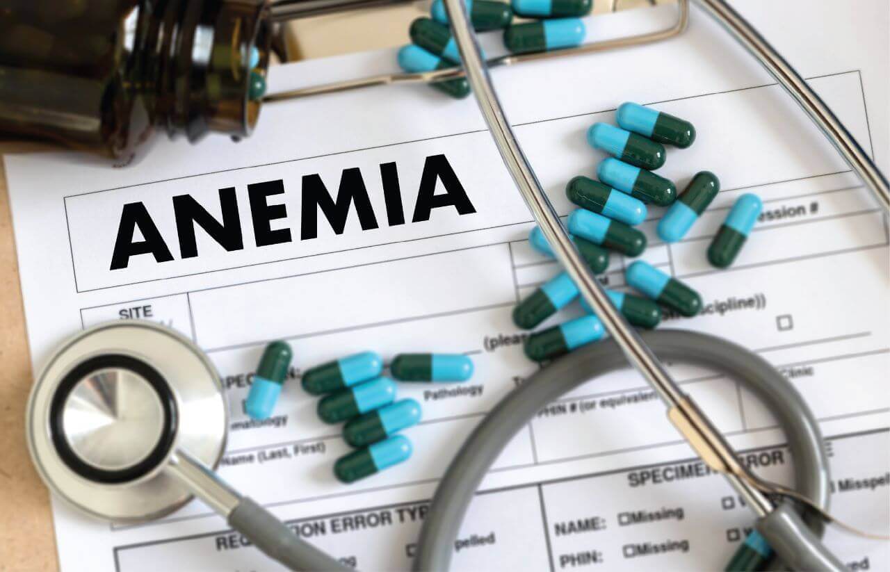 Read more about the article Efficacy of combined immunosuppression with or without eltrombopag in children with newly diagnosed aplastic anemia
