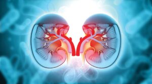 Read more about the article Shifts in Intestinal Metabolic Profile Among Kidney Transplantation Recipients with Antibody-Mediated Rejection