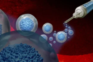 Read more about the article Bacterial Pathogens Causing Pneumonia Post Hematopoietic Stem Cell Transplant: The Chronic GVHD Population