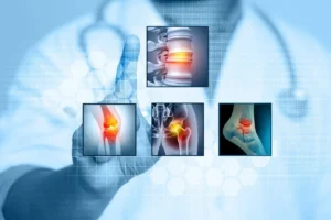 Read more about the article Role of the Granzyme Family in Rheumatoid Arthritis: Current Insights and Future Perspectives