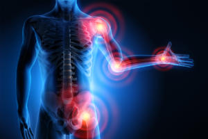 Read more about the article Lymphatic vessels: roles and potential therapeutic intervention in rheumatoid arthritis and osteoarthritis