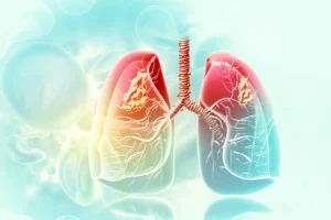 Read more about the article Risk factors for interstitial lung disease in rheumatoid arthritis: a cohort study from the KOBIO registry