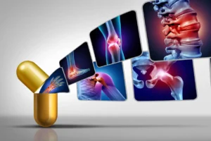 Read more about the article Abatacept in individuals at high risk of rheumatoid arthritis (APIPPRA): a randomised, double-blind, multicentre, parallel, placebo-controlled, phase 2b clinical trial