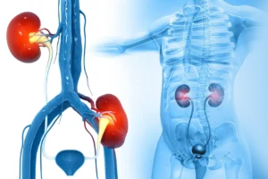 Read more about the article Towards non-invasive diagnostic techniques for early detection of acute renal transplant rejection: A review