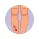 Clean-And-Protect-Any-Cuts-Or-Wounds