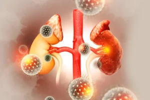 Read more about the article The Treatment of Acute Antibody-Mediated Rejection in Kidney Transplant Recipients A Systematic Review