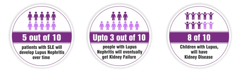 How-Lupus-Affects-Kidneys