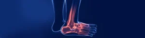 clinical-practice-guideline-for-the-management -of-the-foot-and-ankle-in-rheumatoid-arthritis