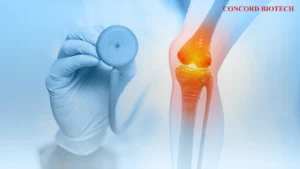 Read more about the article Risk for cardiovascular disease development in rheumatoid arthritis