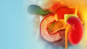 Read more about the article Diabetes Mellitus in Kidney Transplant Recipients: New Horizons in Treatment