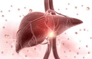 Read more about the article Indications and Long-Term Outcomes of Using Mycophenolate Mofetil Monotherapy in Substitution for Calcineurin Inhibitors in Liver Transplantation