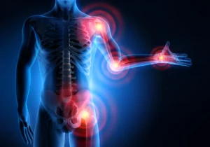 Update-on-tocilizumab-in-rheumatoid-arthritis- a-narrative-review