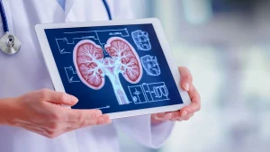 Read more about the article Exploring the Role of Extracorporeal Photopheresis in Kidney Transplant Management